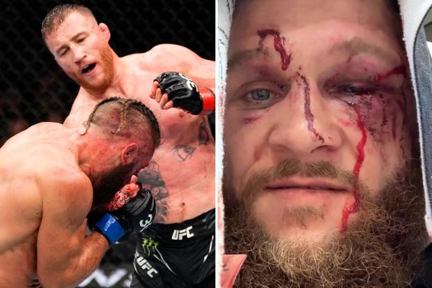 “我们为此而生”——UFC 明星拉斐尔·菲齐耶夫 (Rafael Fiziev) 在与贾斯汀·盖瑟杰 (Justin Gaethje) 的战争后展示了血淋淋、伤痕累累的脸
