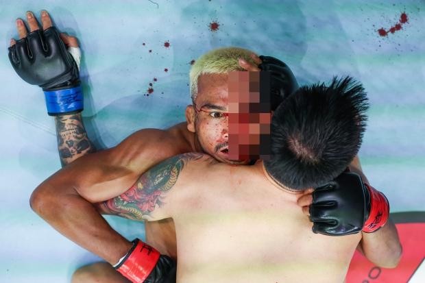 MMA明星在残酷的战斗中遭受恐怖的眼部凿伤后满脸是血