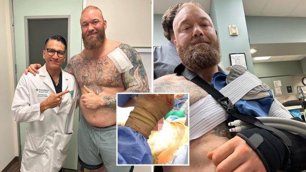 Hafthor Bjornsson 在需要引流管后发布图形手术视频时展示了胸部的巨大疤痕