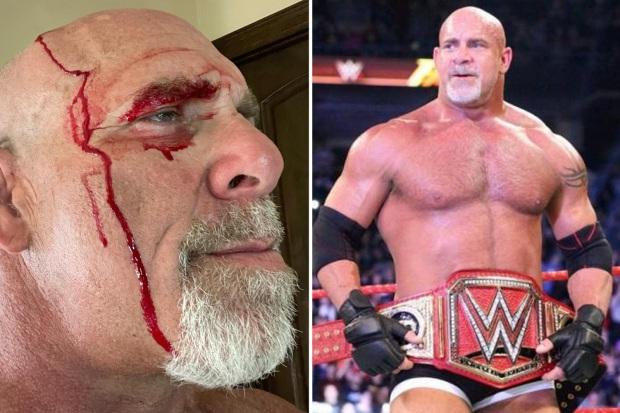 WWE 偶像比尔戈德堡在怪异的拖拉机事故后展示了令人毛骨悚然的头部受伤和流血