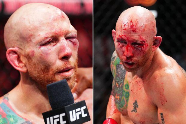 UFC 明星乔什·埃米特 (Josh Emmett) 在 UFC 杰克逊维尔 (UFC Jacksonville) 的脸部被伊利亚·托普里亚 (Ilia Topuria) “重新排列”后变得面目全非