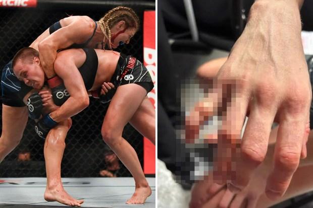 UFC明星罗丝·纳玛尤纳斯在输给曼农·菲奥罗后在一张怪诞的照片中展示了她脱臼的手指
