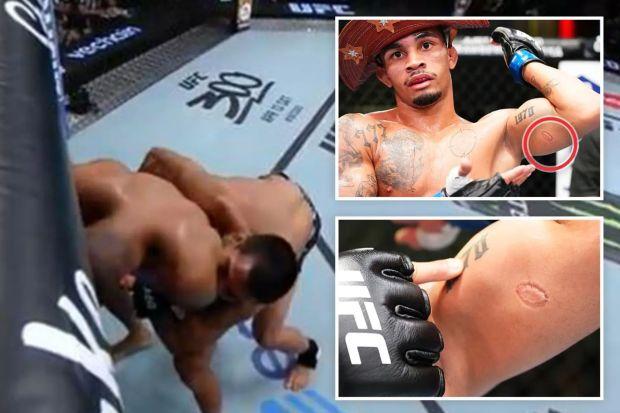 伊戈尔·塞维里诺（Igor Severino）是第一位因在 UFC Vegas 89 比赛中对安德烈·利马（Andre Lima）手臂进行可怕攻击而被取消资格的 UFC 拳手