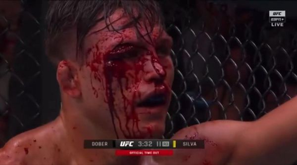 观看血淋淋的 UFC 明星勇敢地继续战斗，尽管他的眼睛被巨大的“严重”割伤，导致他的脸“一团糟”