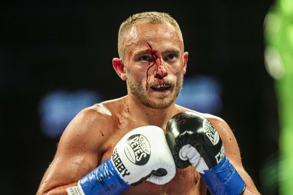 英国拳击手桑尼·爱德华兹 (Sunny Edwards) 在战胜阿德里安·库里尔 (Adrian Curiel) 的比赛中惨遭割伤，脸上流血