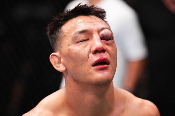 粉丝担心UFC明星在惨败后因严重受伤被送往医院后“可能失去了眼睛”
