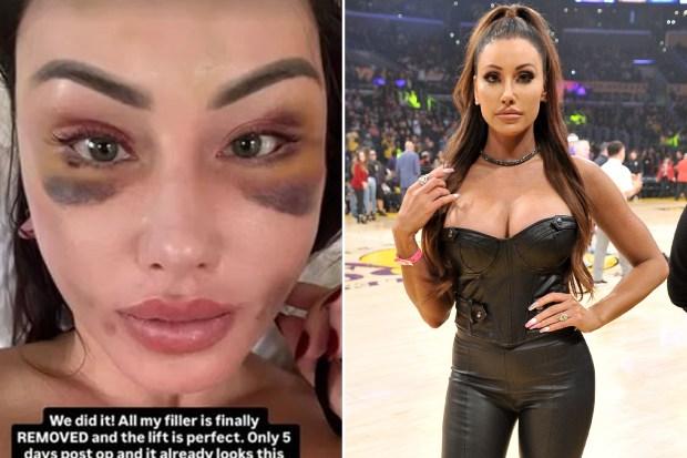 前高尔夫频道和裸照体育联赛创作者霍莉·苏德斯（Holly Sonders）