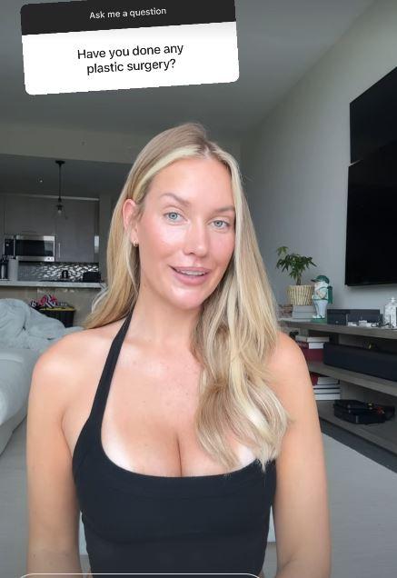 Paige Spiranac揭示了她在Boob Job的“很多猜测”之后所进行的每一刻整容手术